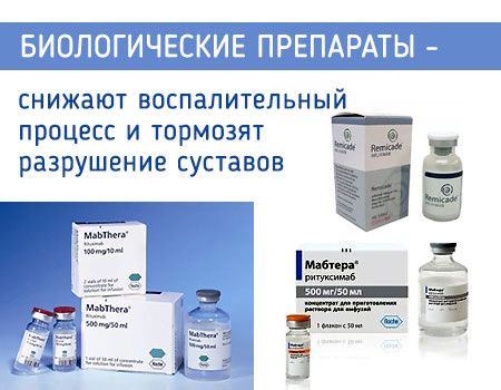 Биологические препараты: Инфликсимаб, Ритуксимаб (мабтера)