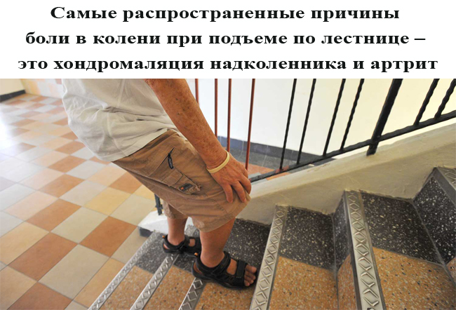 Совершенную человеком при подъеме по лестнице. Боль при подъеме по лестнице. Коленка болит при подъеме по ступеням. Боль в колене по лестнице. Болит колено при подъеме по лестнице.