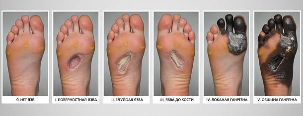 ���� ���-10 ��� ������������� �����